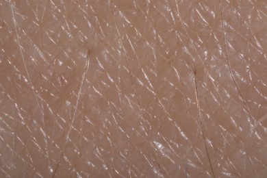 Photo of Macro view of human skin as background