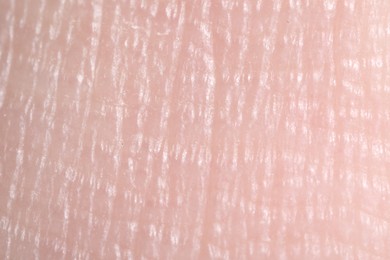 Photo of Macro view of human skin as background