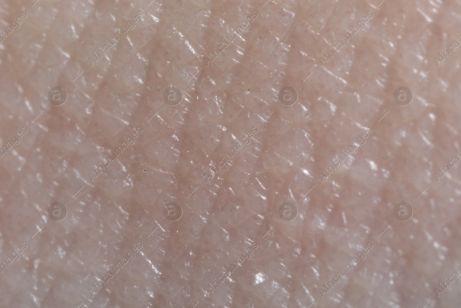 Macro view of human skin as background Photo of Macro view of human skin as background