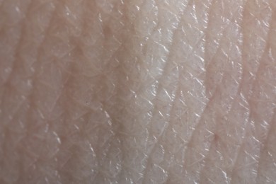 Photo of Macro view of human skin as background