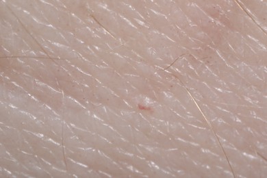 Photo of Macro view of human skin as background