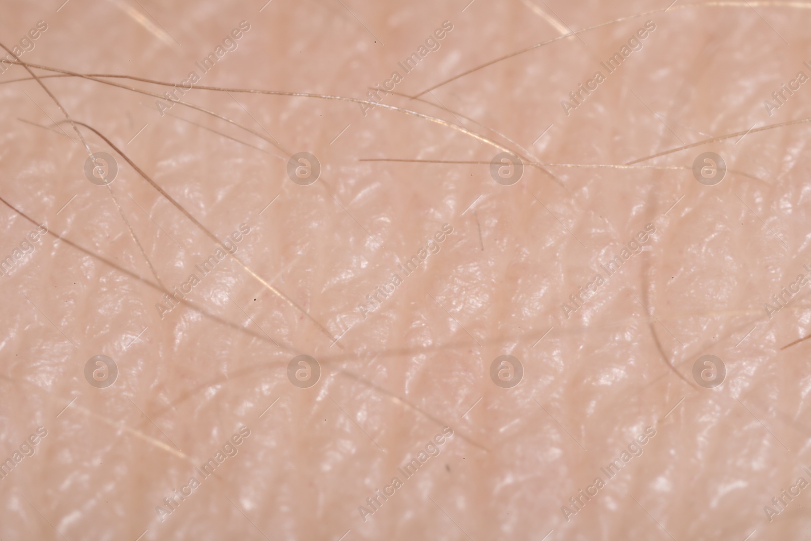 Macro view of human skin as background Photo of Macro view of human skin as background