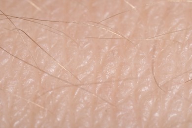 Photo of Macro view of human skin as background