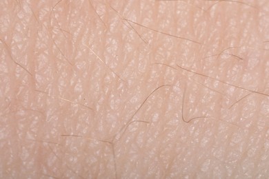 Photo of Macro view of human skin as background