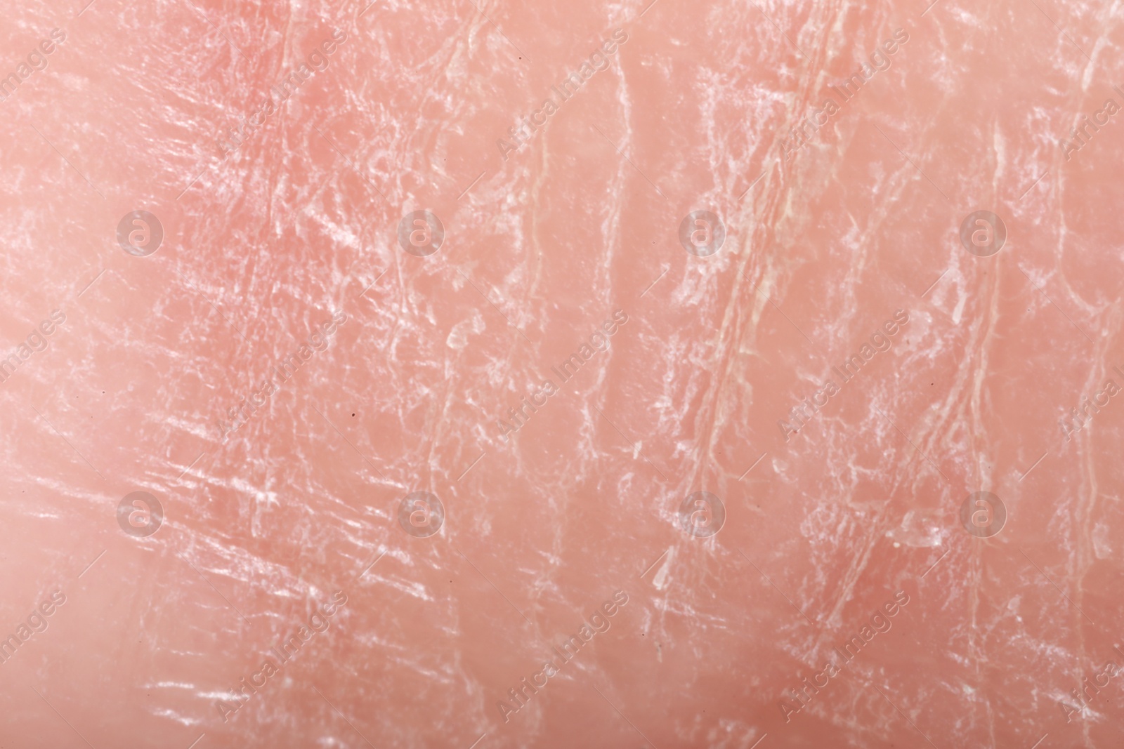 Macro view of dry human skin as background Photo of Macro view of dry human skin as background