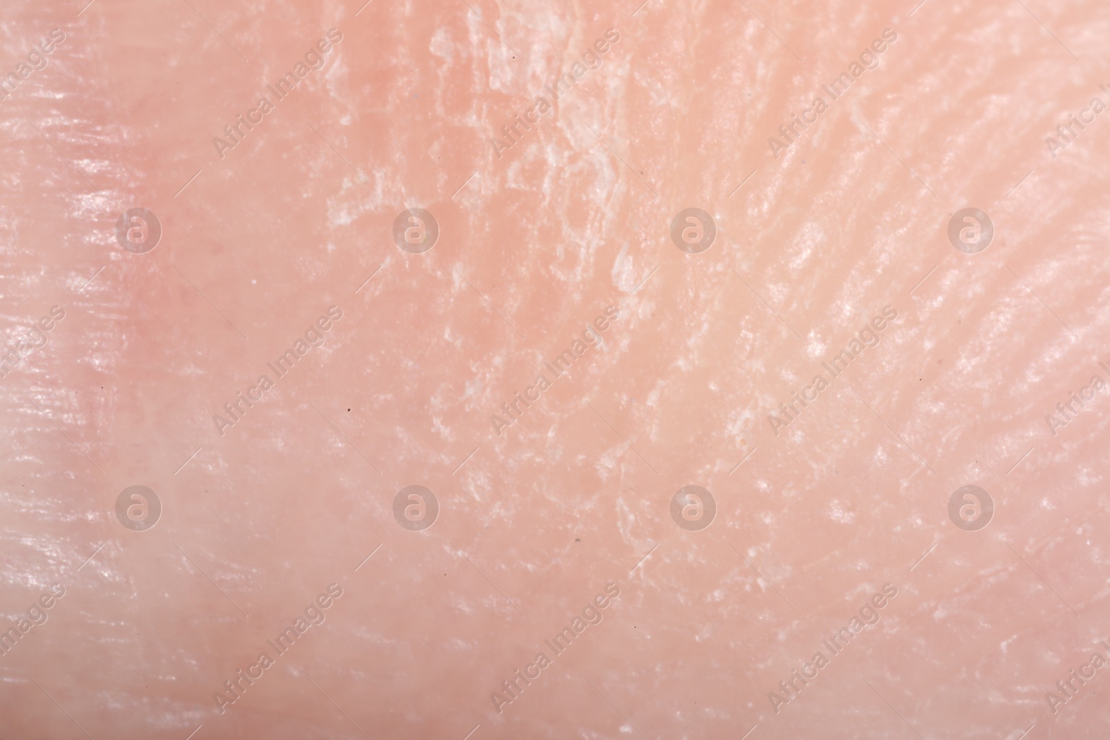 Macro view of dry human skin as background Photo of Macro view of dry human skin as background