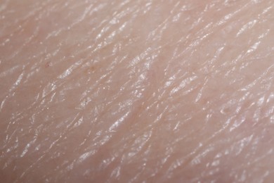 Photo of Macro view of human skin as background
