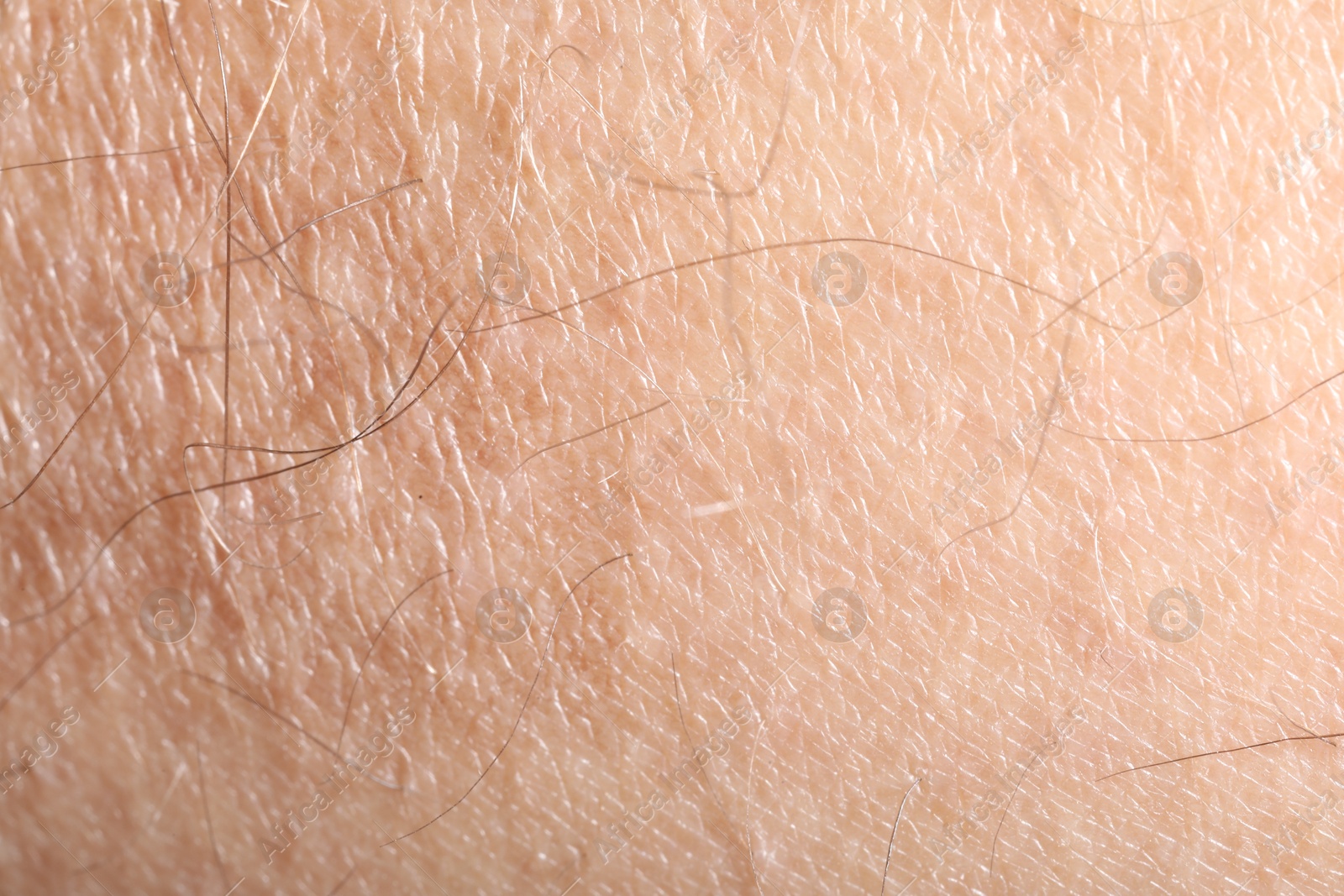 Macro view of human skin as background Photo of Macro view of human skin as background