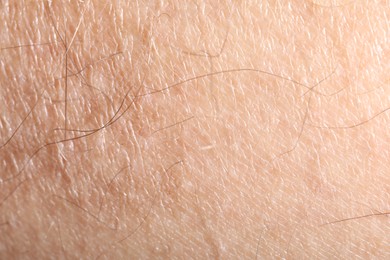 Photo of Macro view of human skin as background