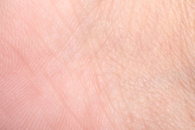 Photo of Macro view of human skin with wrinkles as background