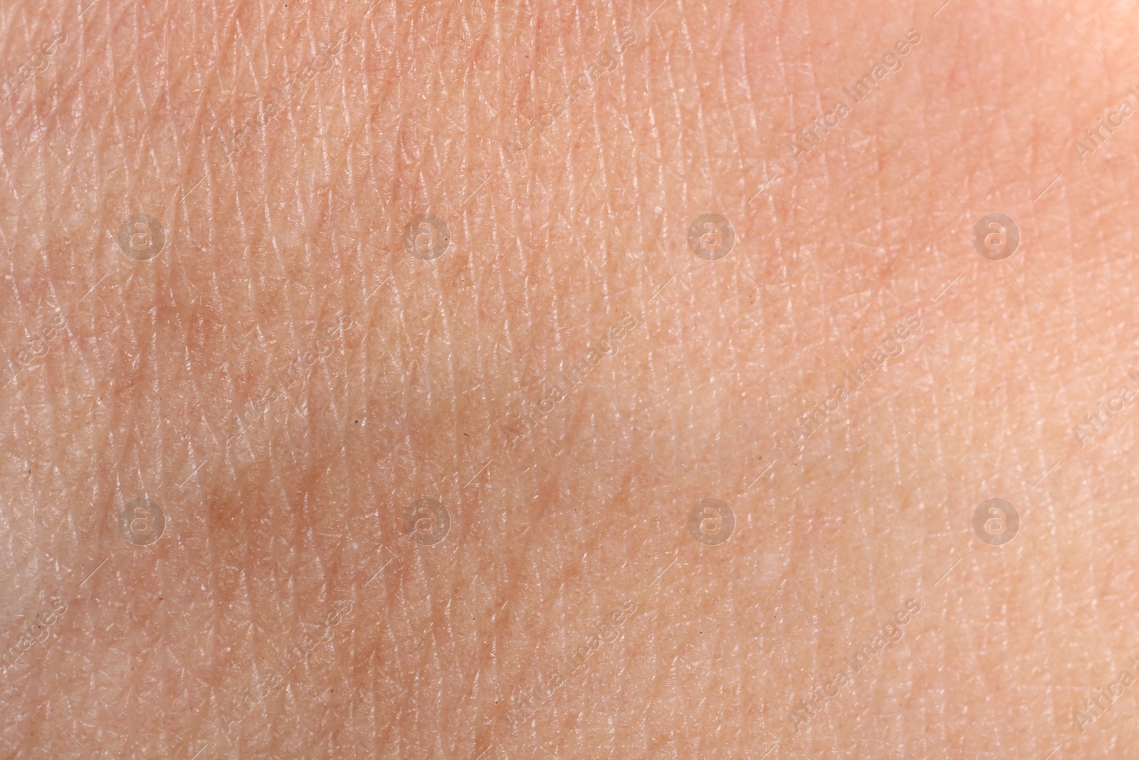 Macro view of human skin with wrinkles as background Photo of Macro view of human skin with wrinkles as background