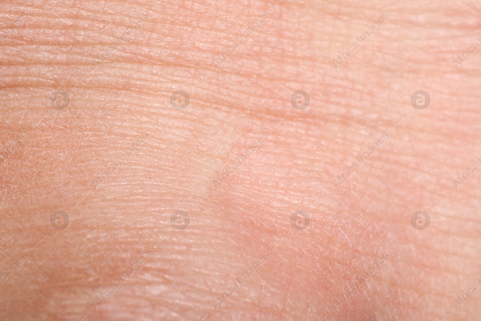 Macro view of human skin with wrinkles as background Photo of Macro view of human skin with wrinkles as background