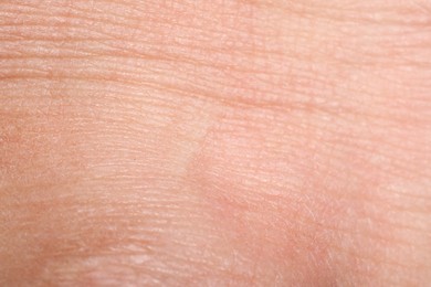 Photo of Macro view of human skin with wrinkles as background