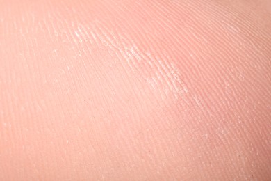 Photo of Macro view of dry human skin with wrinkles as background