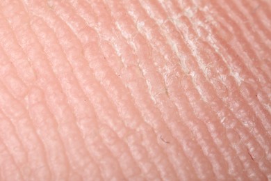Photo of Macro view of dry human skin with wrinkles as background