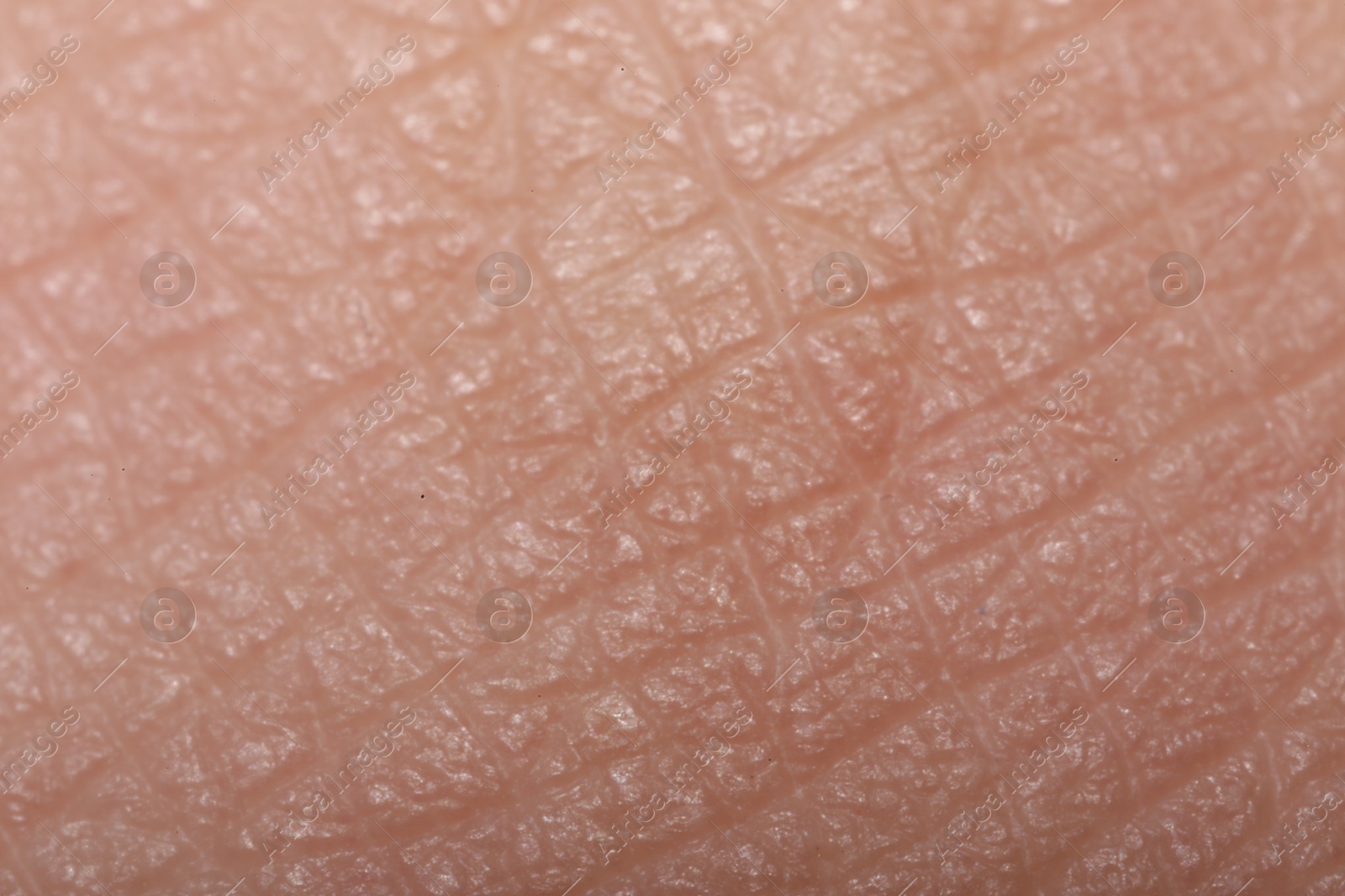 Macro view of dry human skin with wrinkles as background Photo of Macro view of dry human skin with wrinkles as background