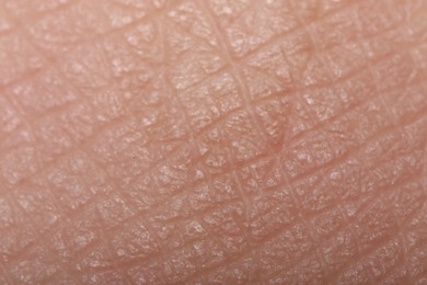 Photo of Macro view of dry human skin with wrinkles as background