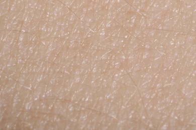 Photo of Macro view of human skin as background