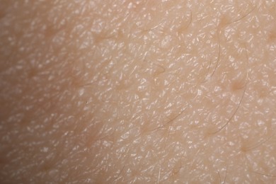 Photo of Macro view of human skin as background