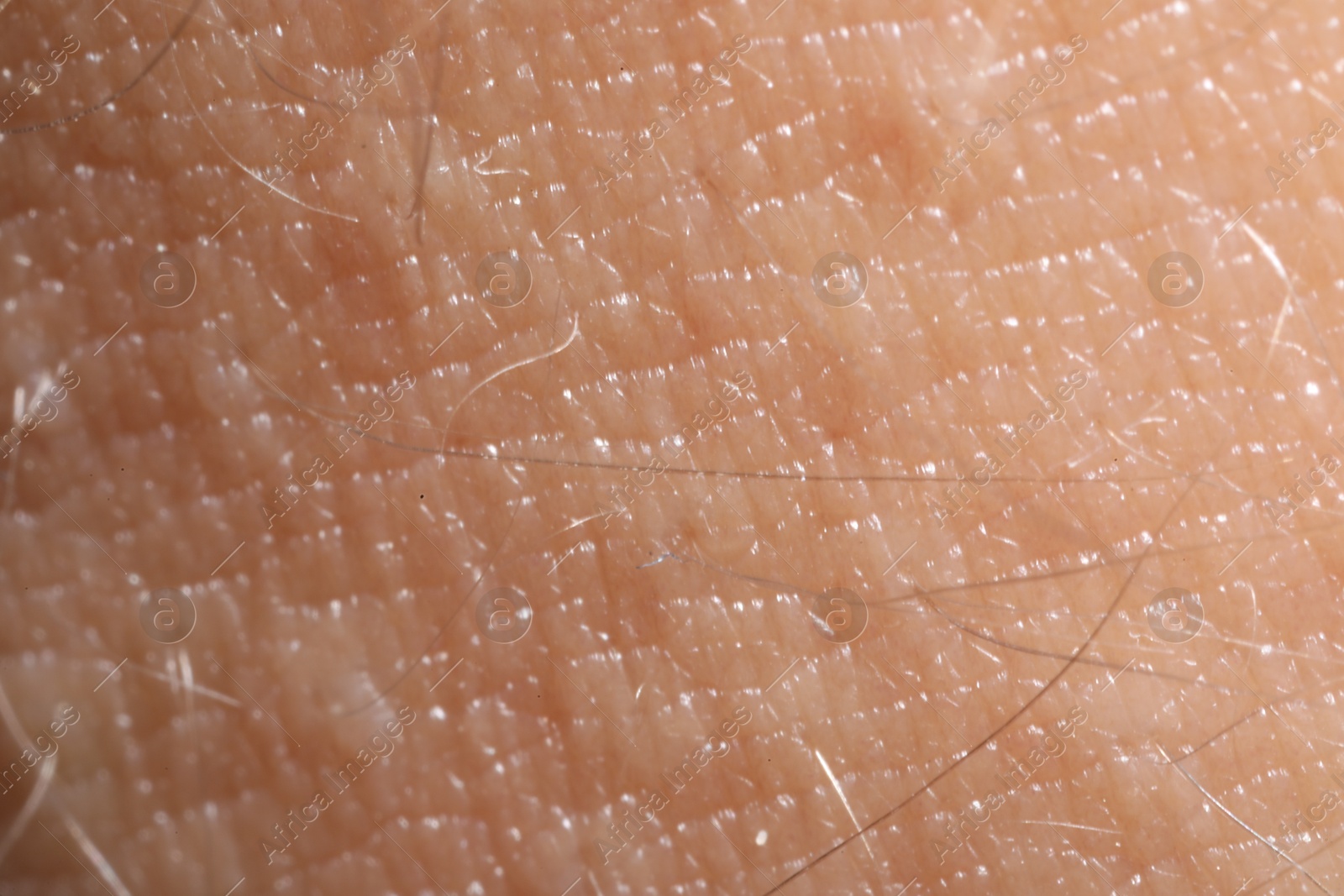 Macro view of human skin as background Photo of Macro view of human skin as background