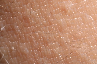 Photo of Macro view of human skin as background