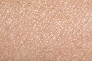 Photo of Macro view of human skin as background