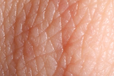 Photo of Macro view of human skin as background