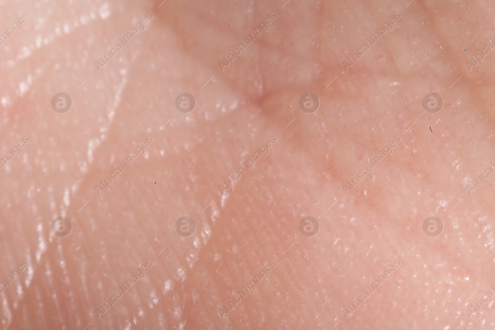 Macro view of human skin as background Photo of Macro view of human skin as background