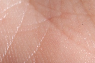 Photo of Macro view of human skin as background