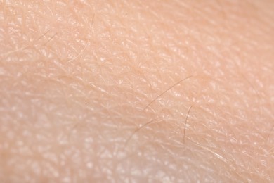 Photo of Macro view of human skin as background
