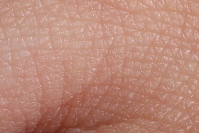 Photo of Macro view of human skin as background