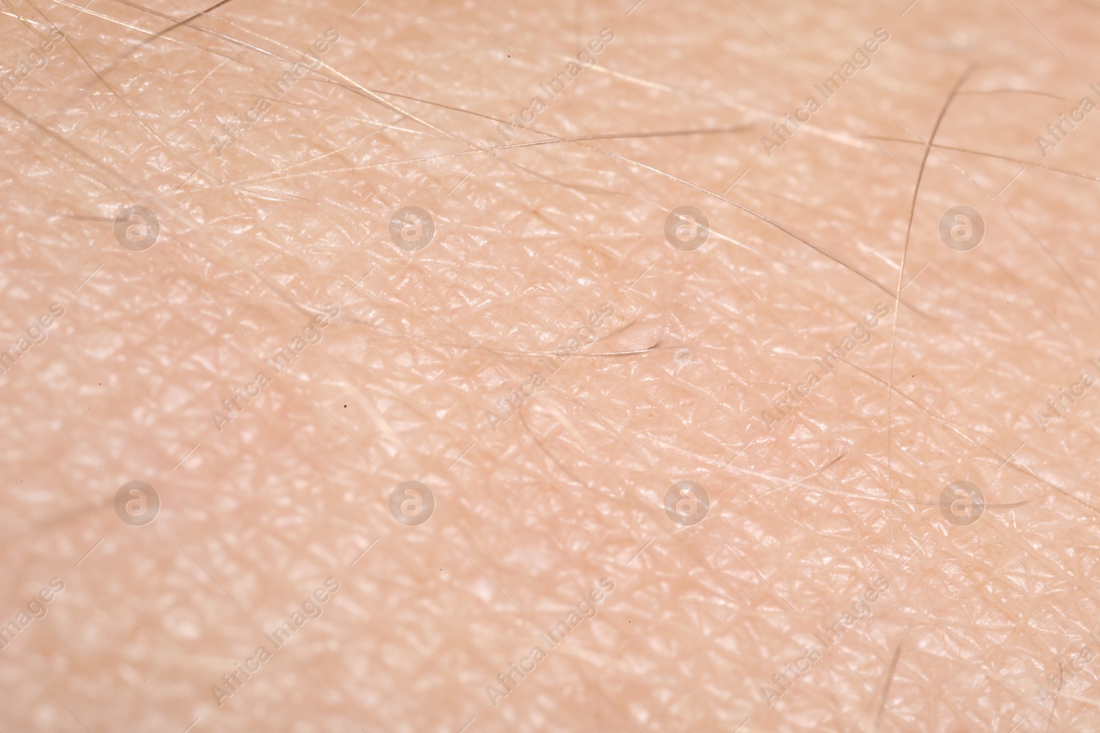 Macro view of human skin as background Photo of Macro view of human skin as background