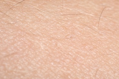 Photo of Macro view of human skin as background