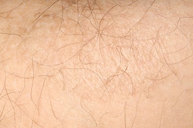 Photo of Macro view of human skin as background