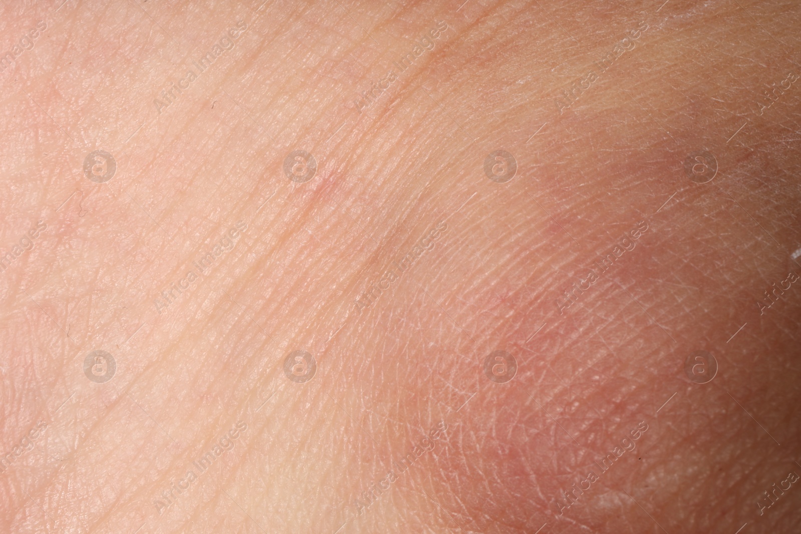 Macro view of human skin as background Photo of Macro view of human skin as background