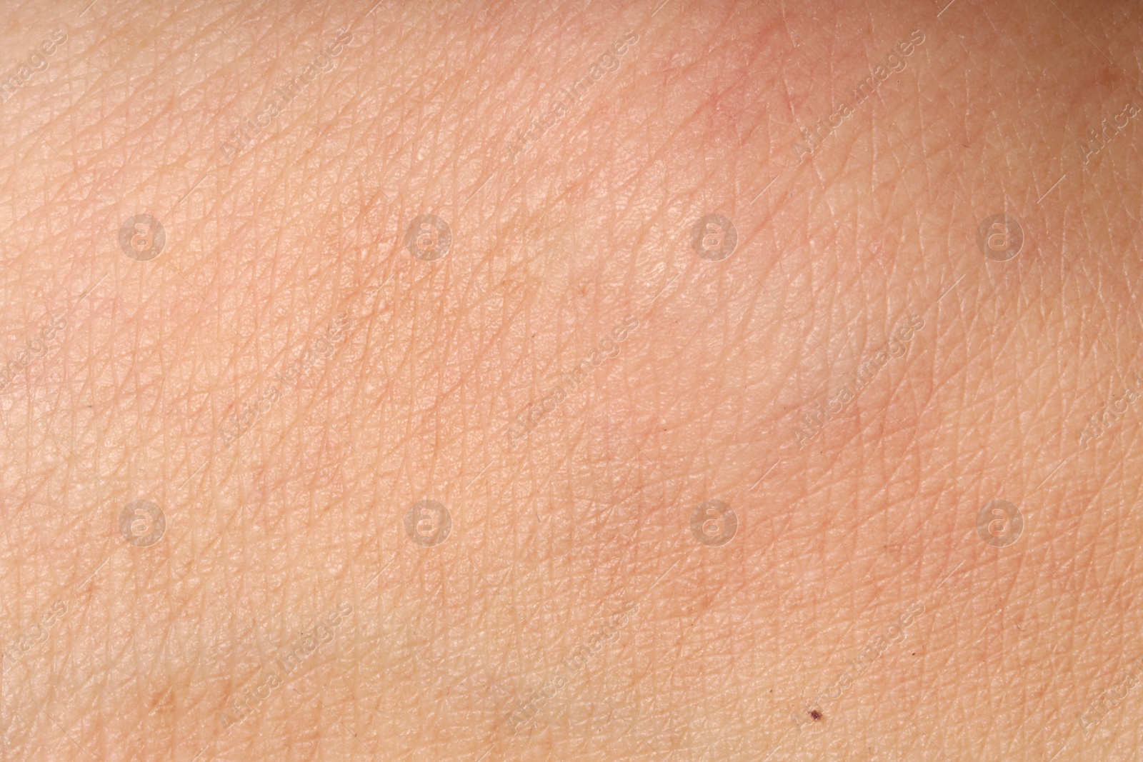 Macro view of human skin as background Photo of Macro view of human skin as background