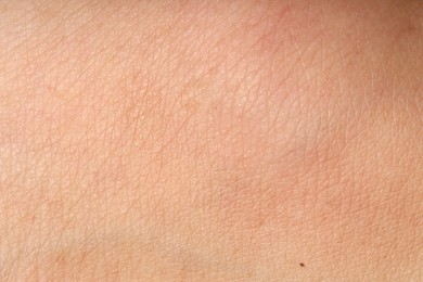 Photo of Macro view of human skin as background