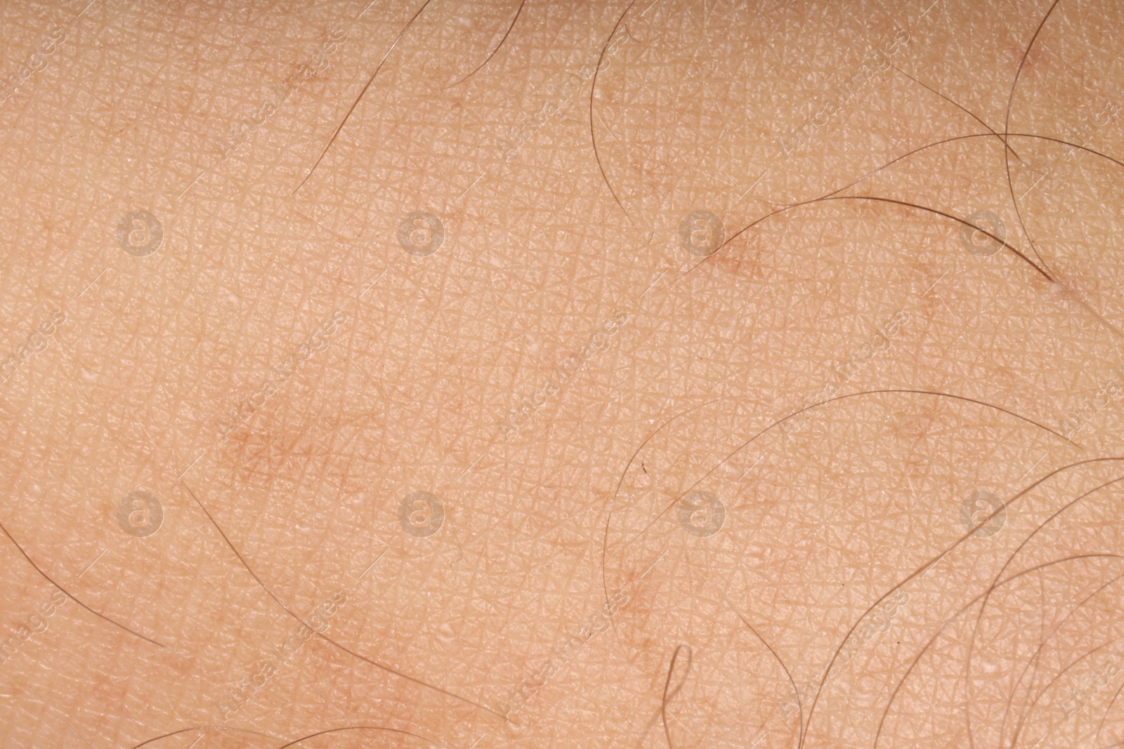 Macro view of human skin with birthmarks as background Photo of Macro view of human skin with birthmarks as background