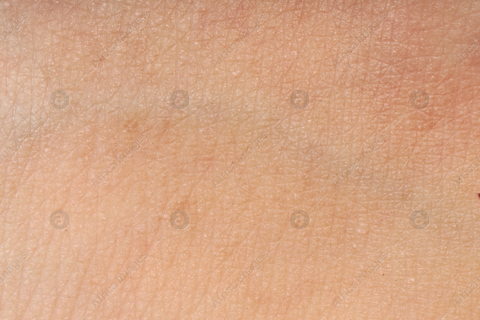 Macro view of human skin as background Photo of Macro view of human skin as background