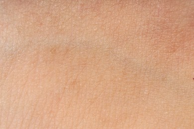 Photo of Macro view of human skin as background