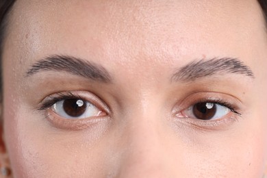 Photo of Closeup view of woman with normal skin