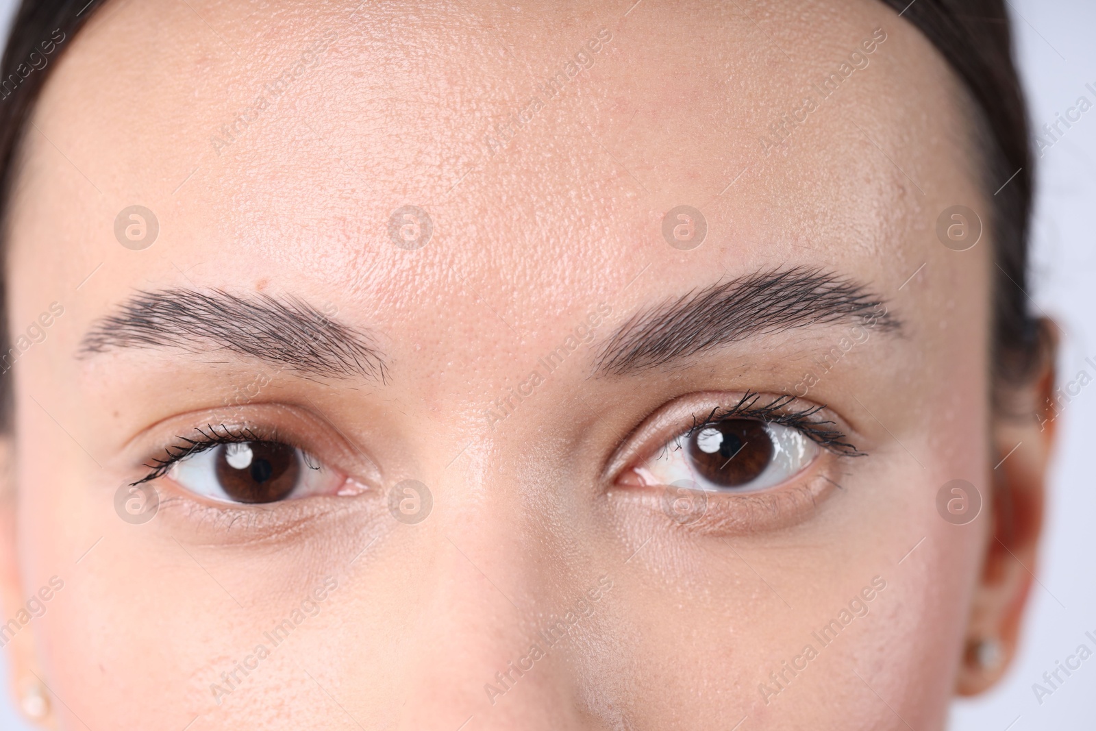Photo of Closeup view of woman with normal skin