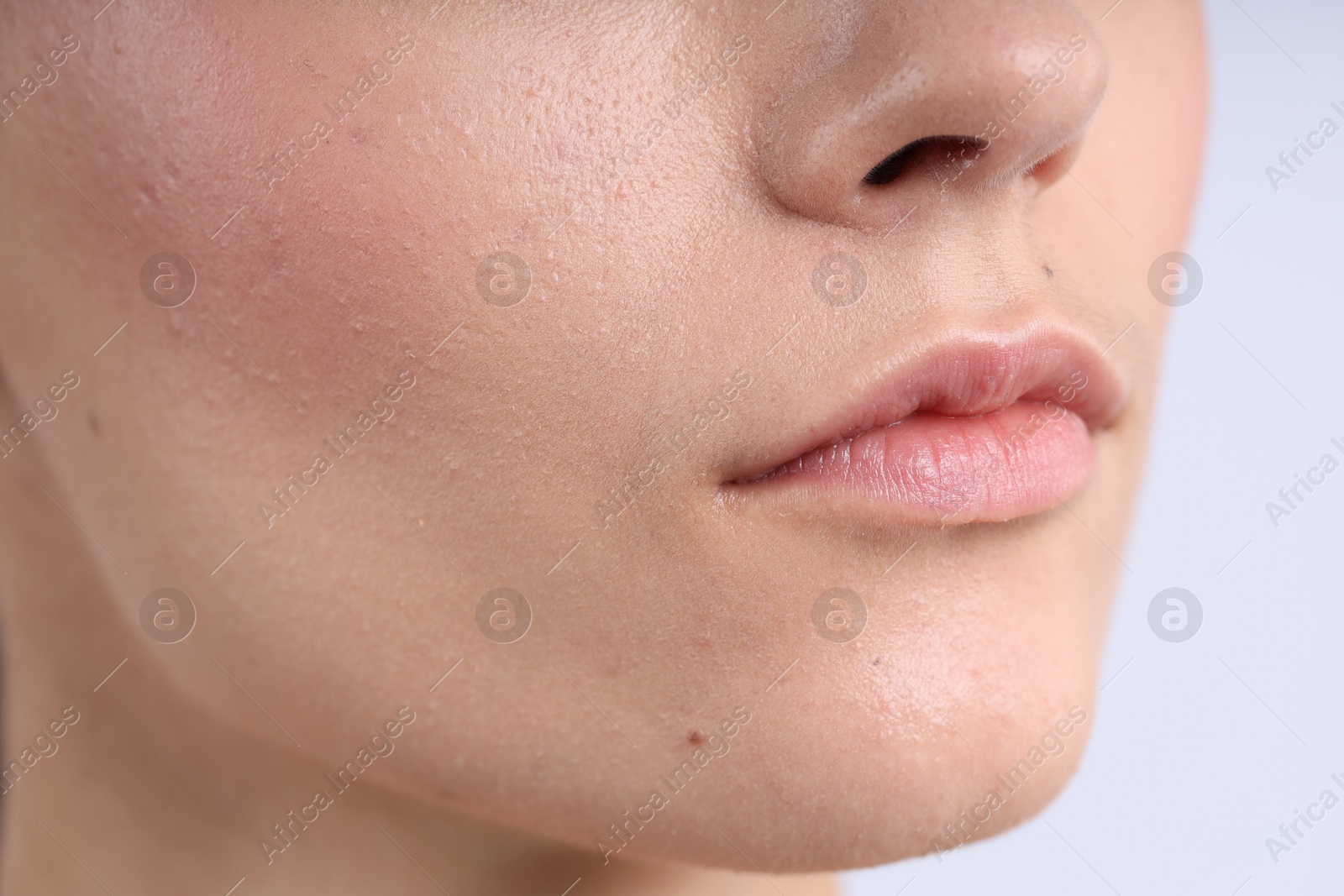 Photo of Woman with normal skin on light background, closeup