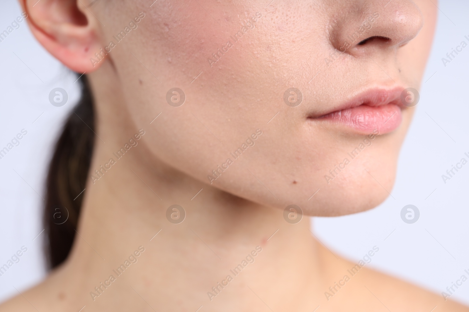 Photo of Woman with normal skin on light background, closeup