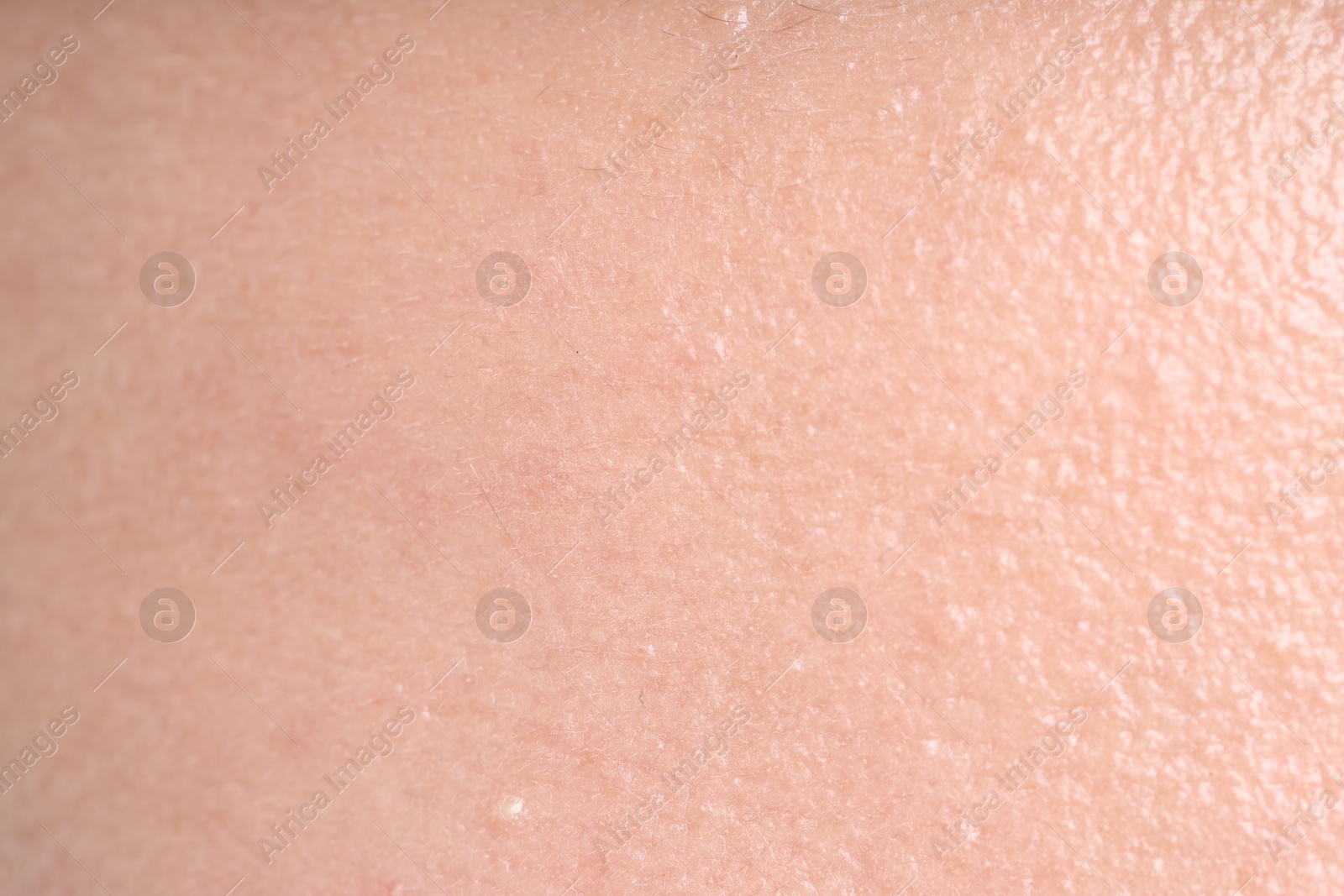 Texture of normal skin as background, closeup Photo of Texture of normal skin as background, closeup