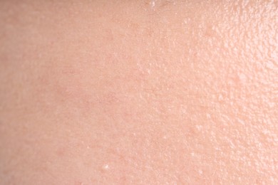 Photo of Texture of normal skin as background, closeup