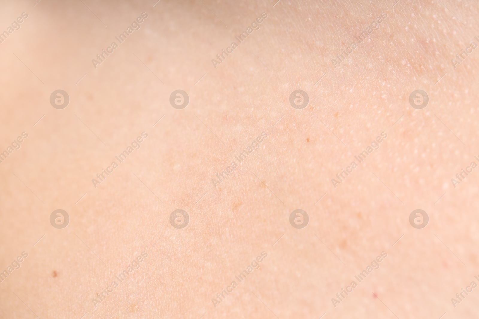 Texture of normal skin as background, closeup Photo of Texture of normal skin as background, closeup