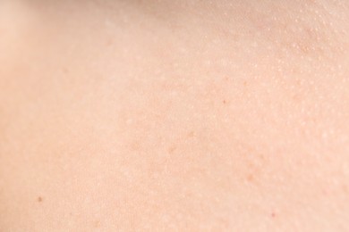 Photo of Texture of normal skin as background, closeup