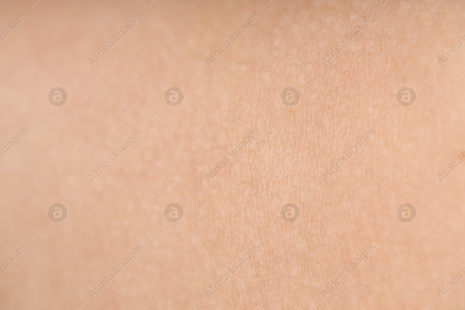 Texture of normal skin as background, closeup Photo of Texture of normal skin as background, closeup