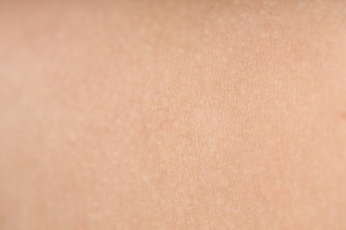 Photo of Texture of normal skin as background, closeup